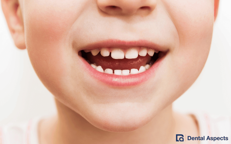 How to Manage a Toddler’s Toothache Straight from the Dentist Tips