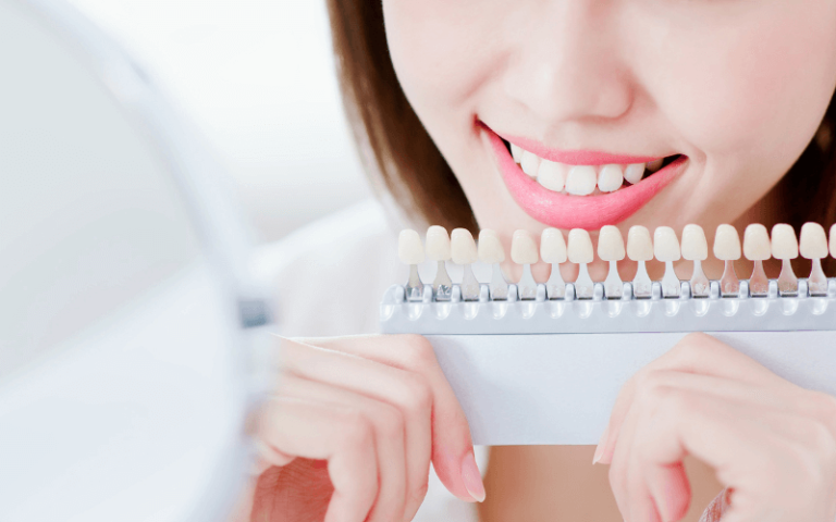 How to Maintain Your Smile After Teeth Whitening (2)